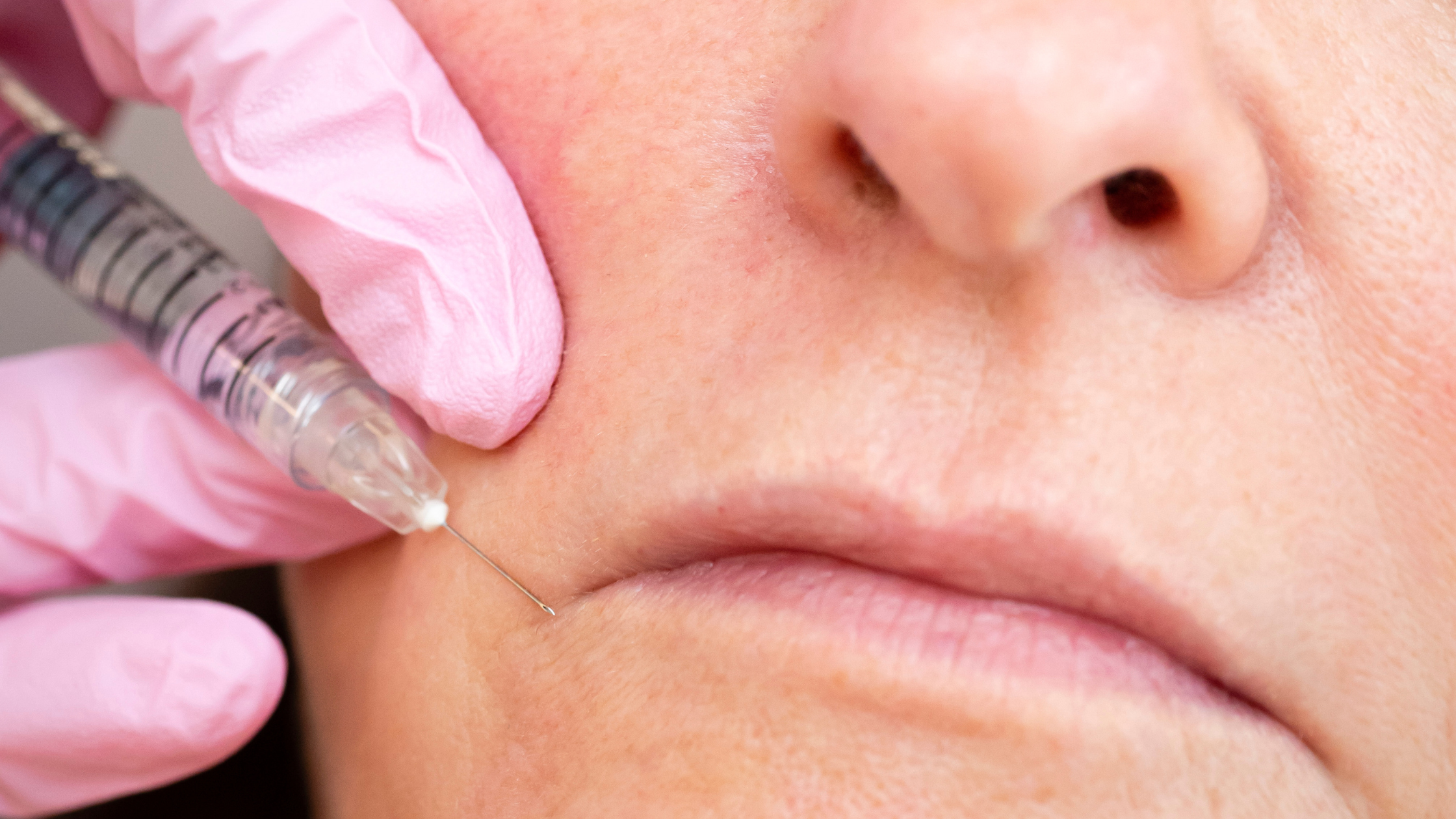 En qué consiste el tratamiento de mentón en medicina estética