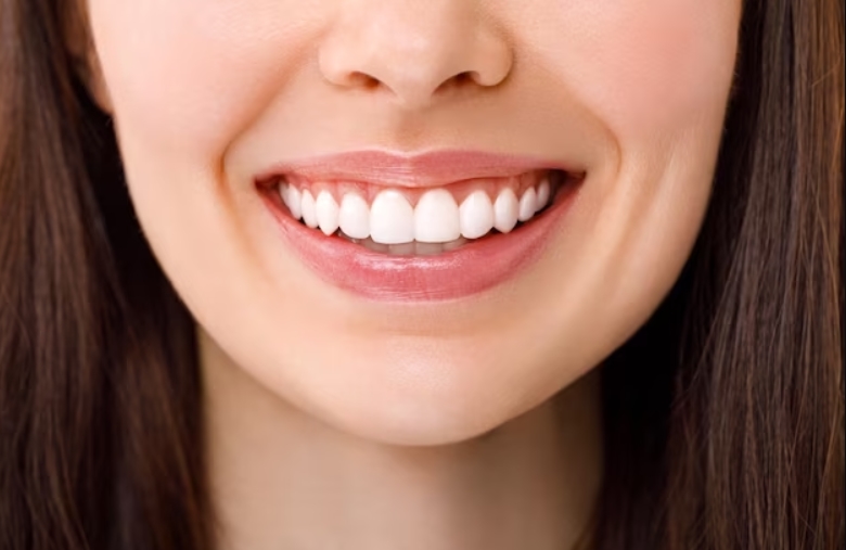 tratamiento Sonrisa gingival en Barcelona